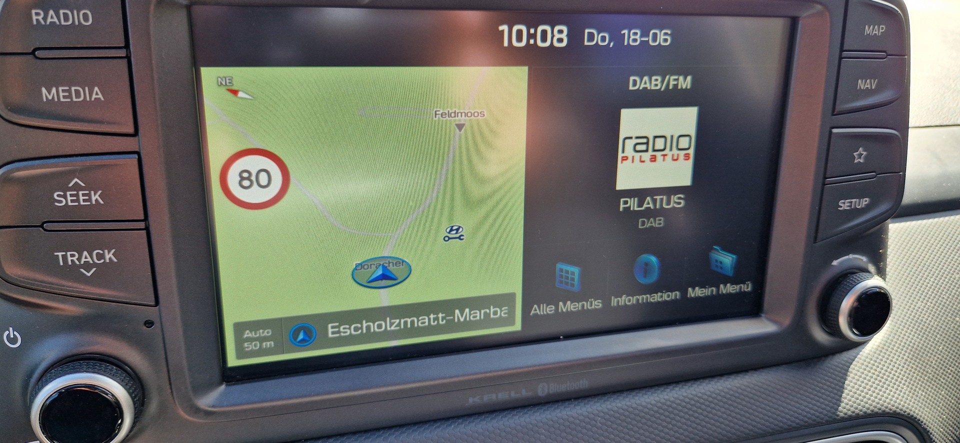 HYUNDAI Kona 1.6 T-GDi Launch 4WD DCT-image-10